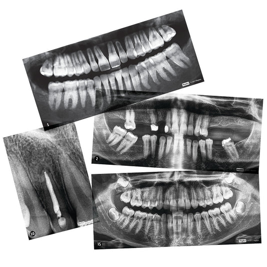 Dental X-Rays